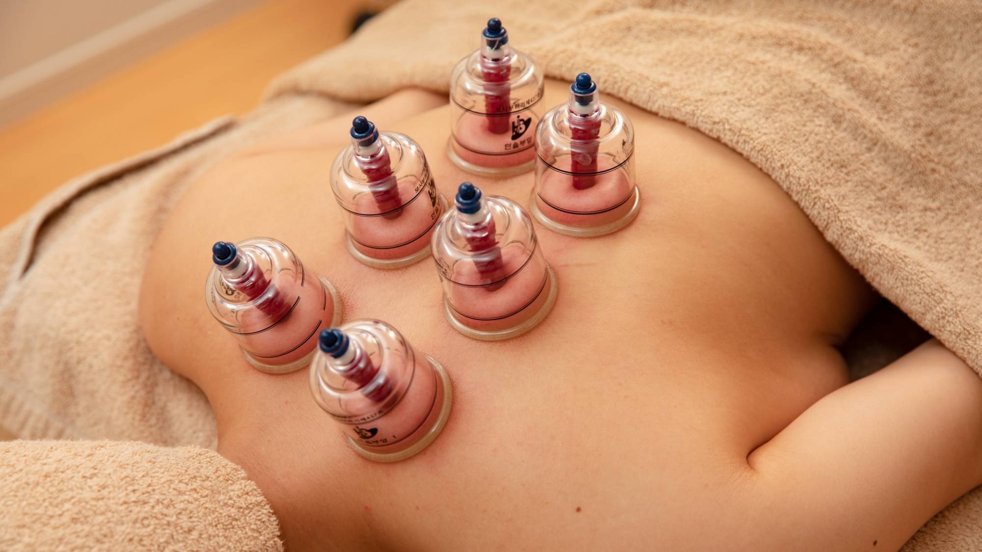 ・【オプション】スライドカッピング