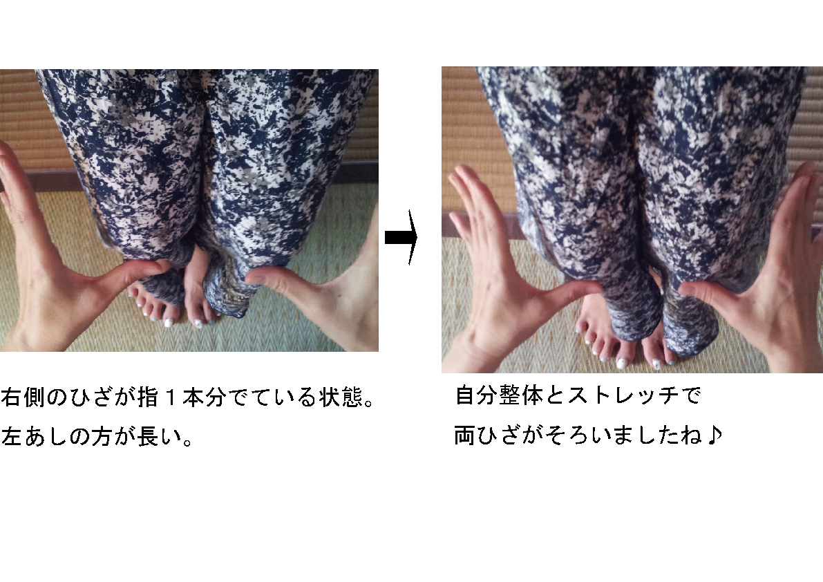 あしの長さ調整（要予約・有料）